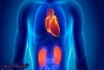 استنشاق اکسید نیتریک در طول جراحی موجب کم کردن پرسشها کلیوی می شود
